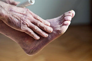 What Can Cause Poor Foot Circulation?