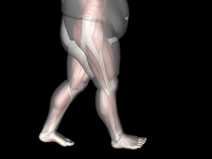 Excessive Weight May Cause Foot Conditions